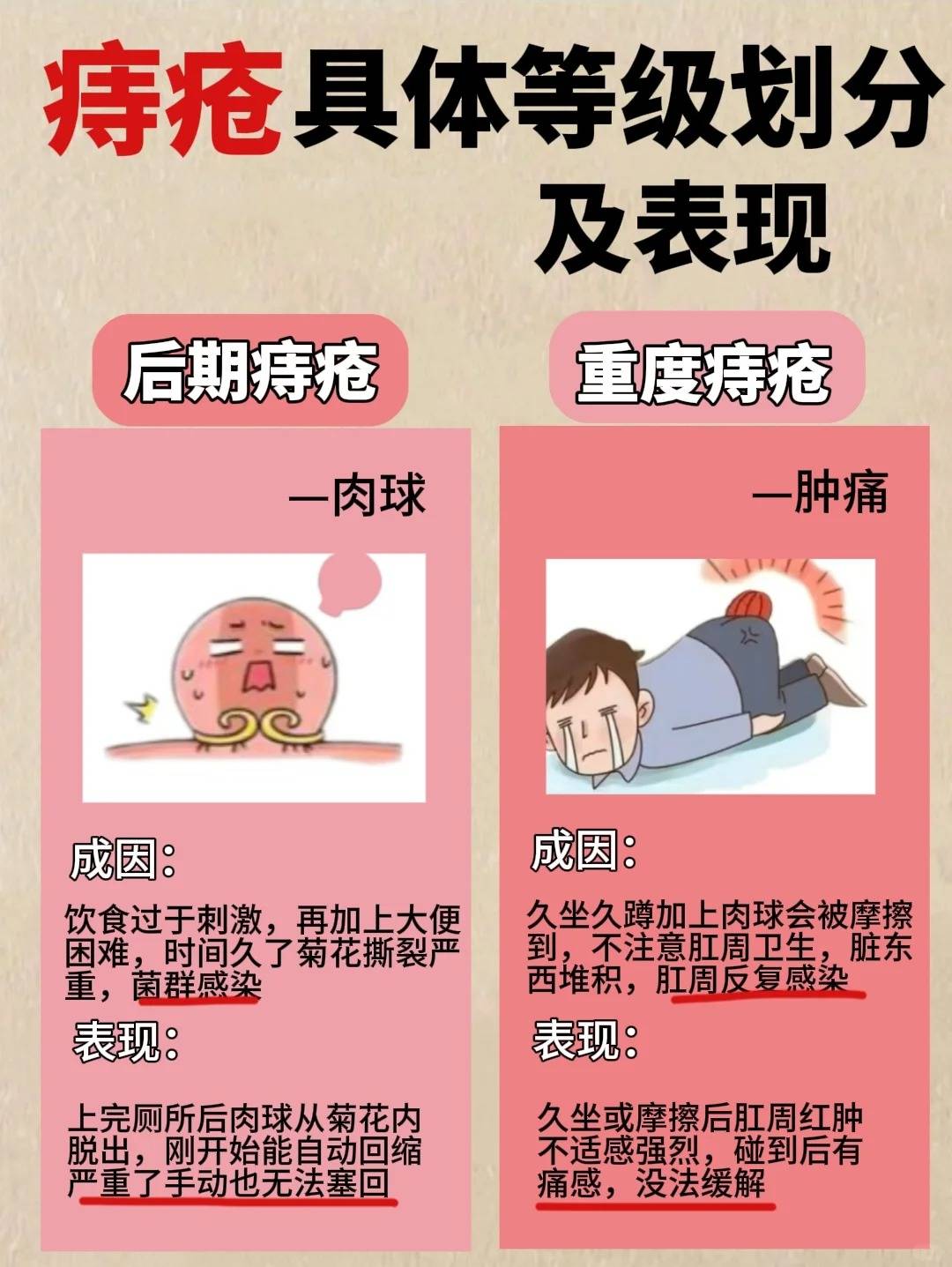 痔疮分期的症状图片图片