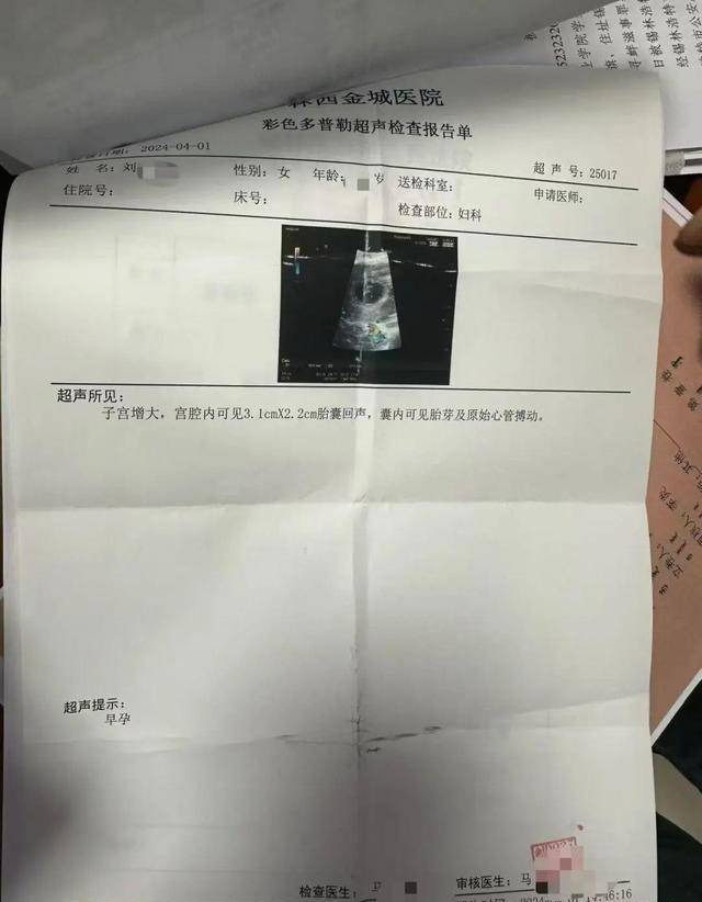 早孕检查报告单图片