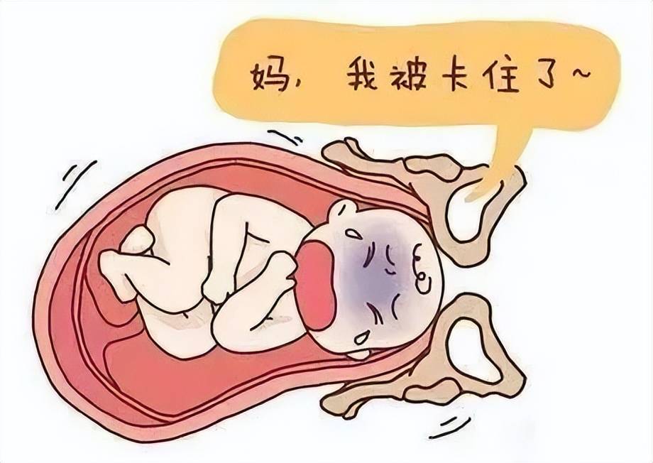 了相当长的"黑暗时期",那些未能提前出生的母亲和婴儿都因难产而逝