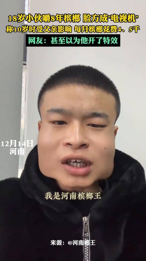 18岁小伙嚼槟榔8年脸方成电视机:单单买槟榔就花了40多万