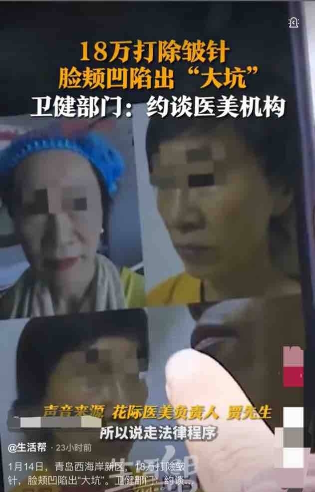 18万元除皱针打出俩大坑 青岛花际医美跨区执业不是头一回(图2)