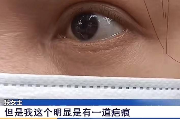 女子割个双眼皮也能“大出血” 南京星海荟医美维权退款难(图6)