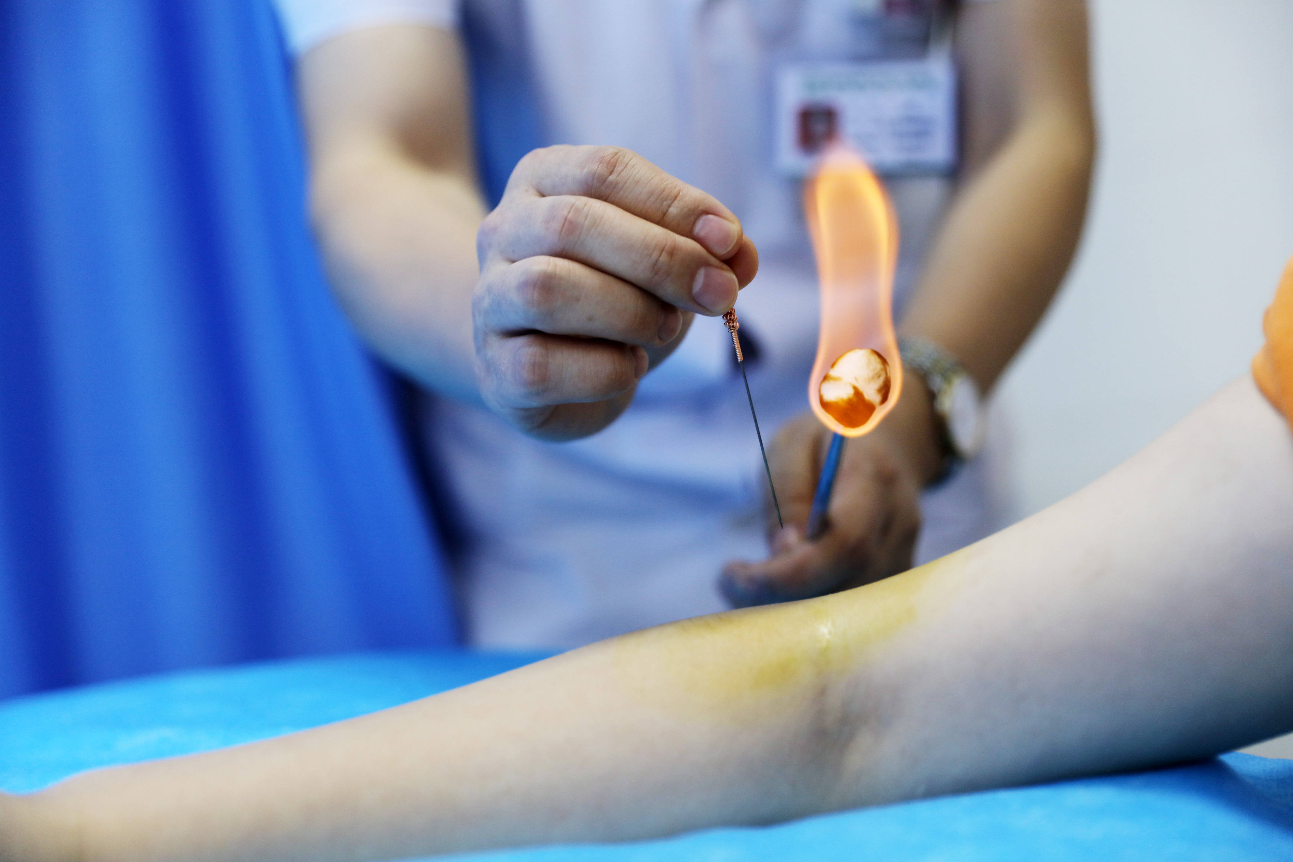 广州中医药大学针灸推拿学专业介绍附报考流程