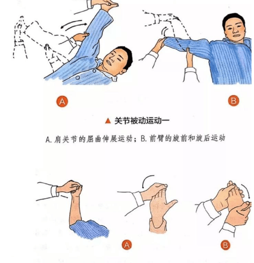 坚持康复训练,对共济失调患者至关重要!