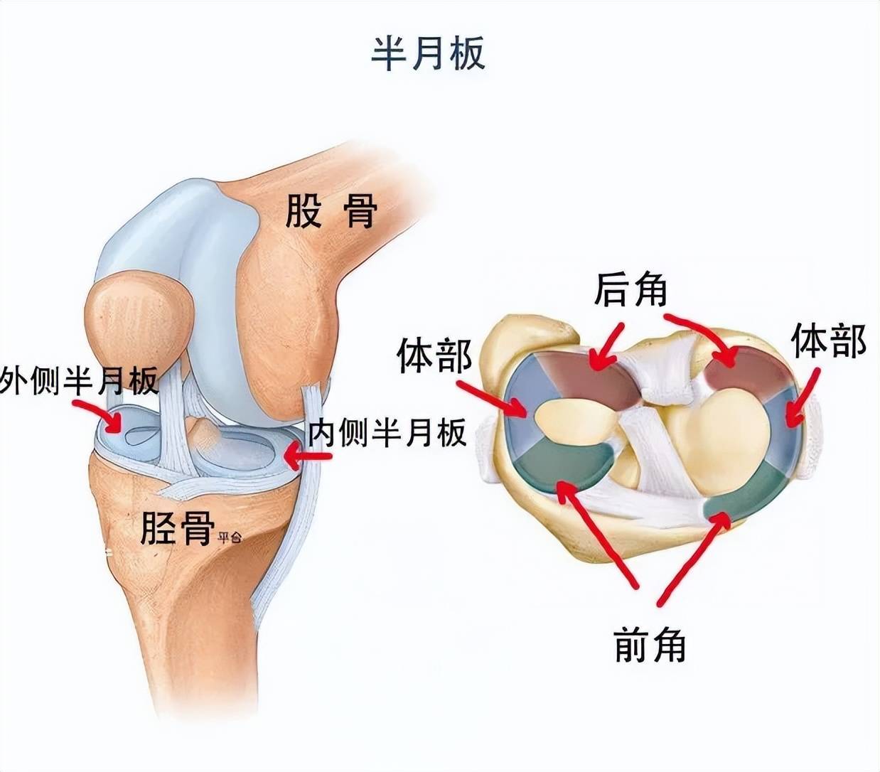半月板康复指南