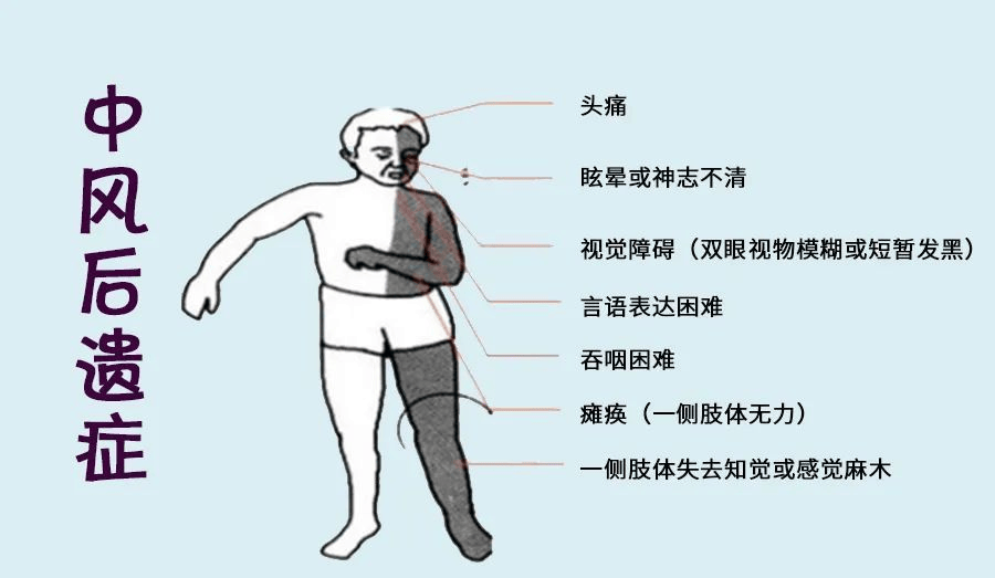 偏瘫会引起哪些人体危害呢?广州治疗偏瘫最好的医院