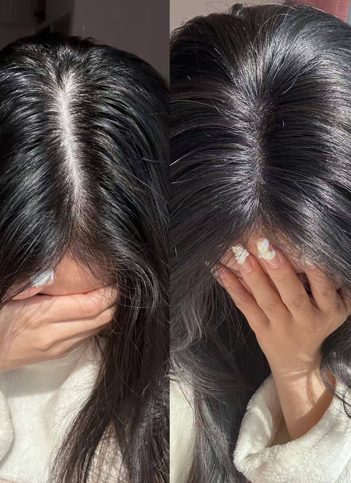 世界公认有效防脱生发产品