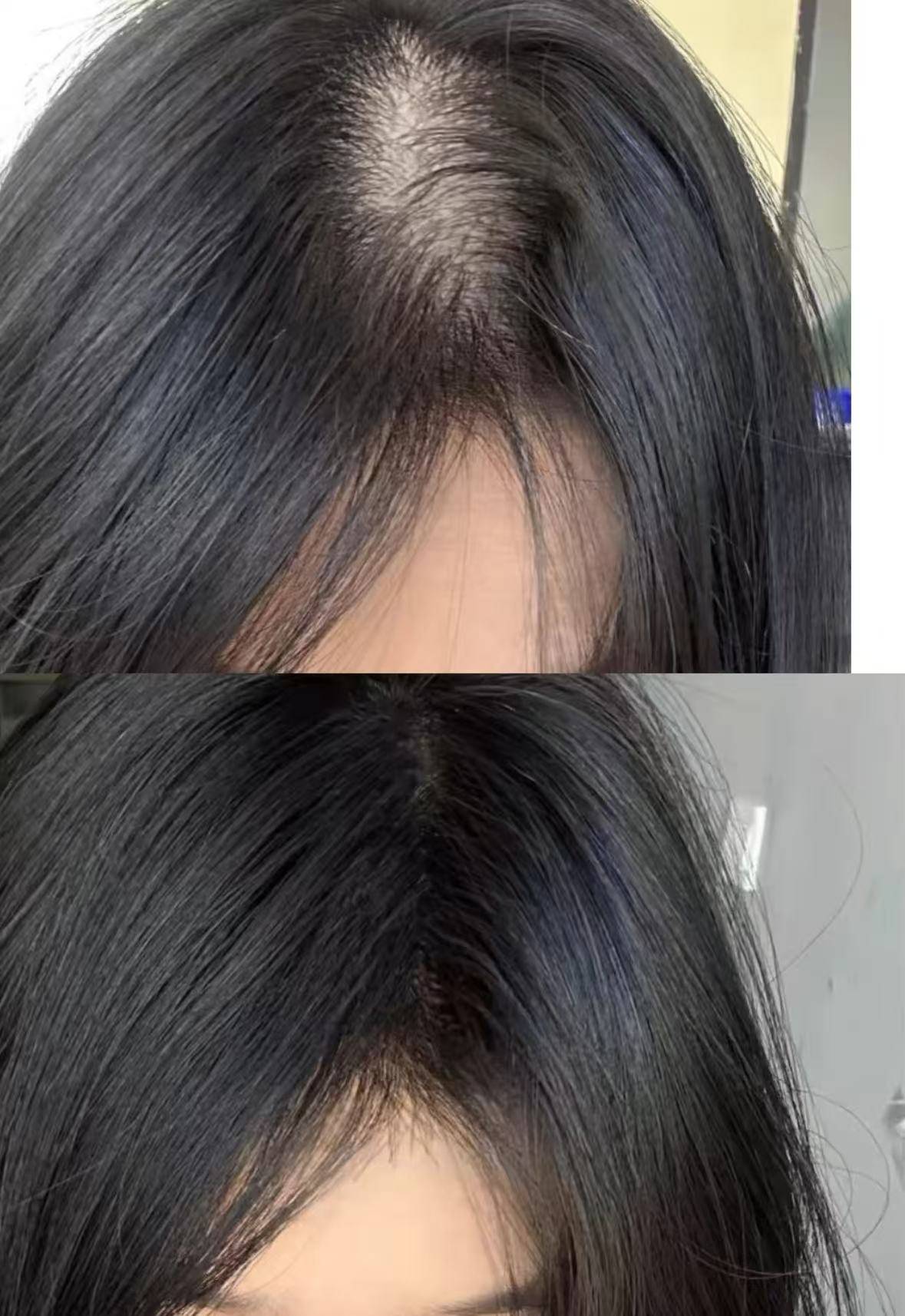 国药唯一承认的防脱生发液测评发量翻倍