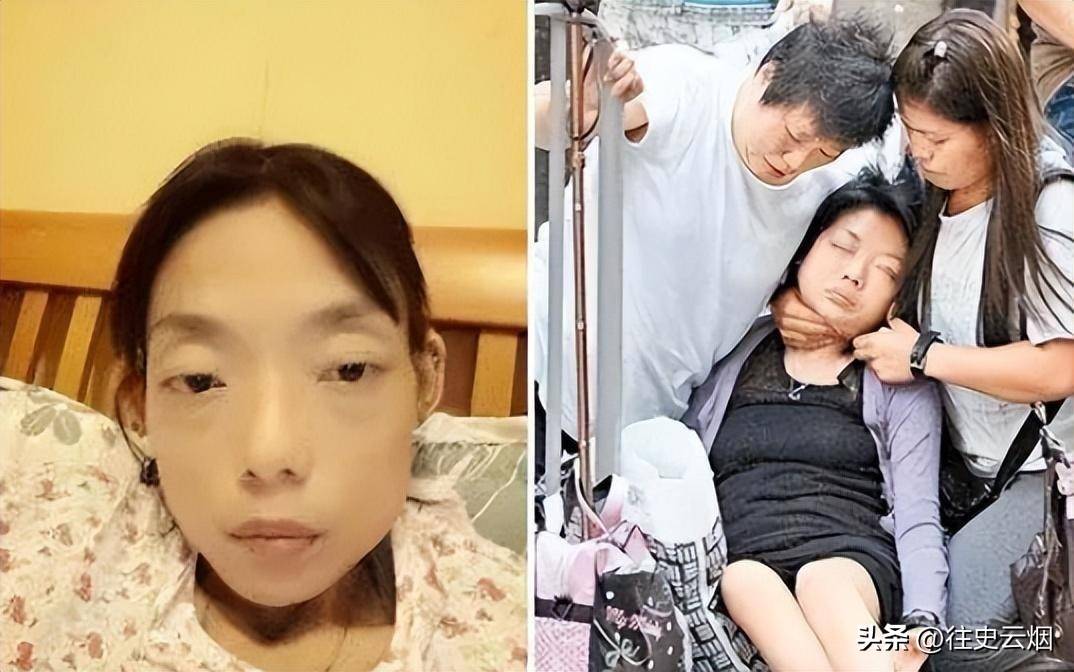 回顾香港名模伍智恒,嫁入豪门8年,被折磨到牙齿全掉,形似骷髅