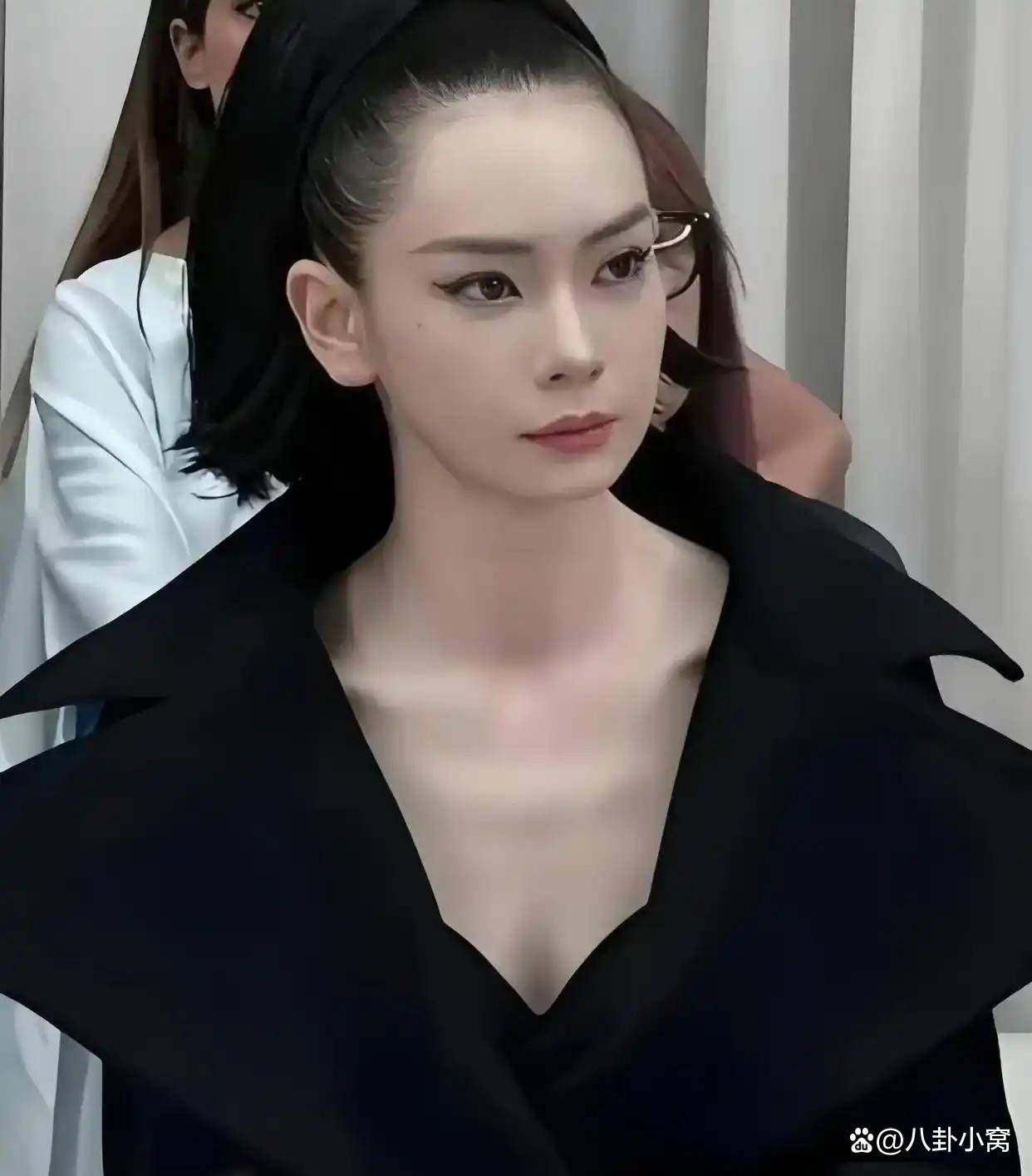戚薇称自己医美过度眉毛完全动不了风波再起戚薇直面吊梢眼争议