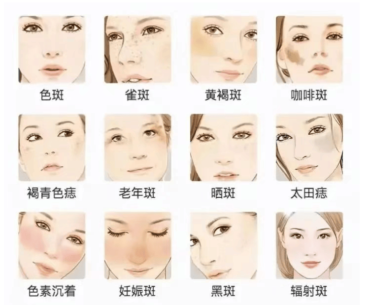 焕瑟祛斑真的那么神奇吗?焕瑟祛斑多少钱一套