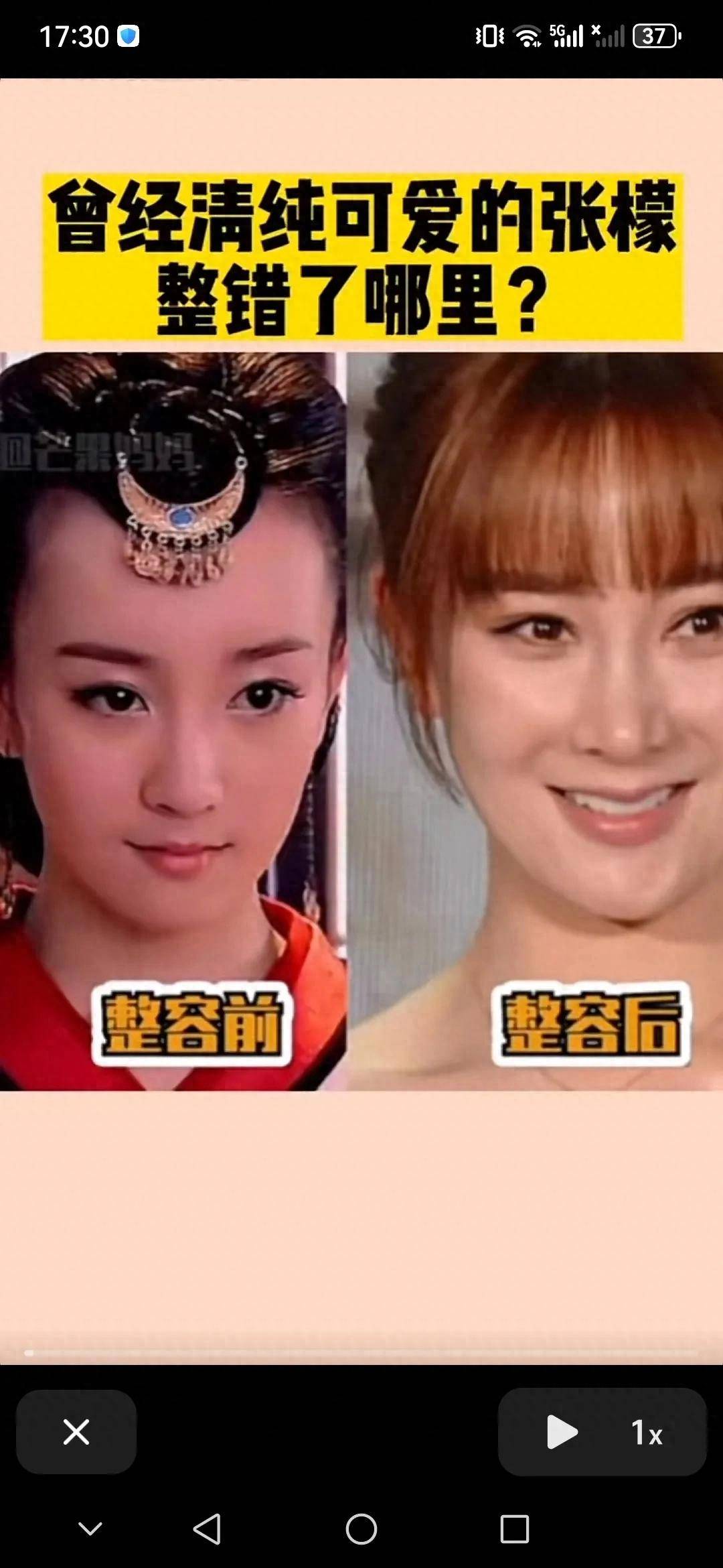 张檬整容毁掉演绎生涯现在备孕又遇难题网友喊话她太作太矫情