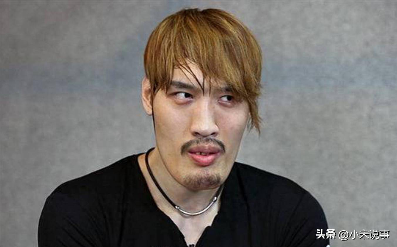 巨人症患者因生长激素分泌异常,不仅面临心脏问题风险,像崔洪万这样