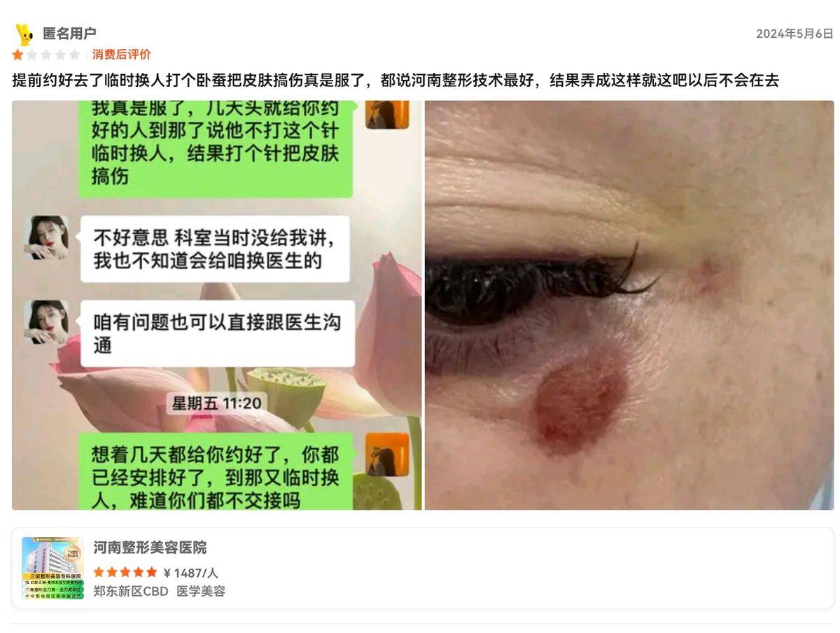 从肉毒素到双眼皮争议 河南整形美容医院如何突破信任困局?(图9)