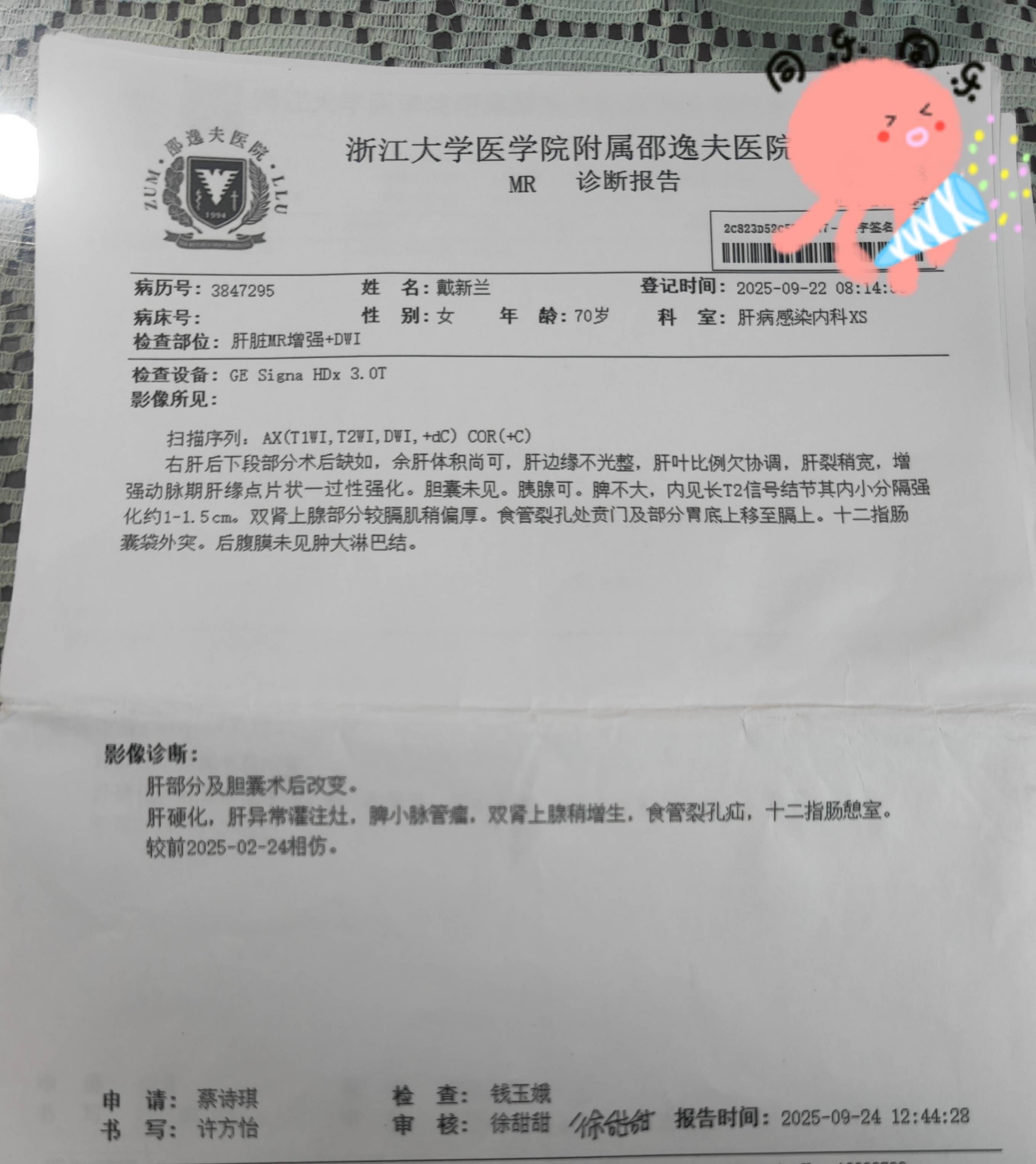从肝硬化到肝癌术后复发风险高