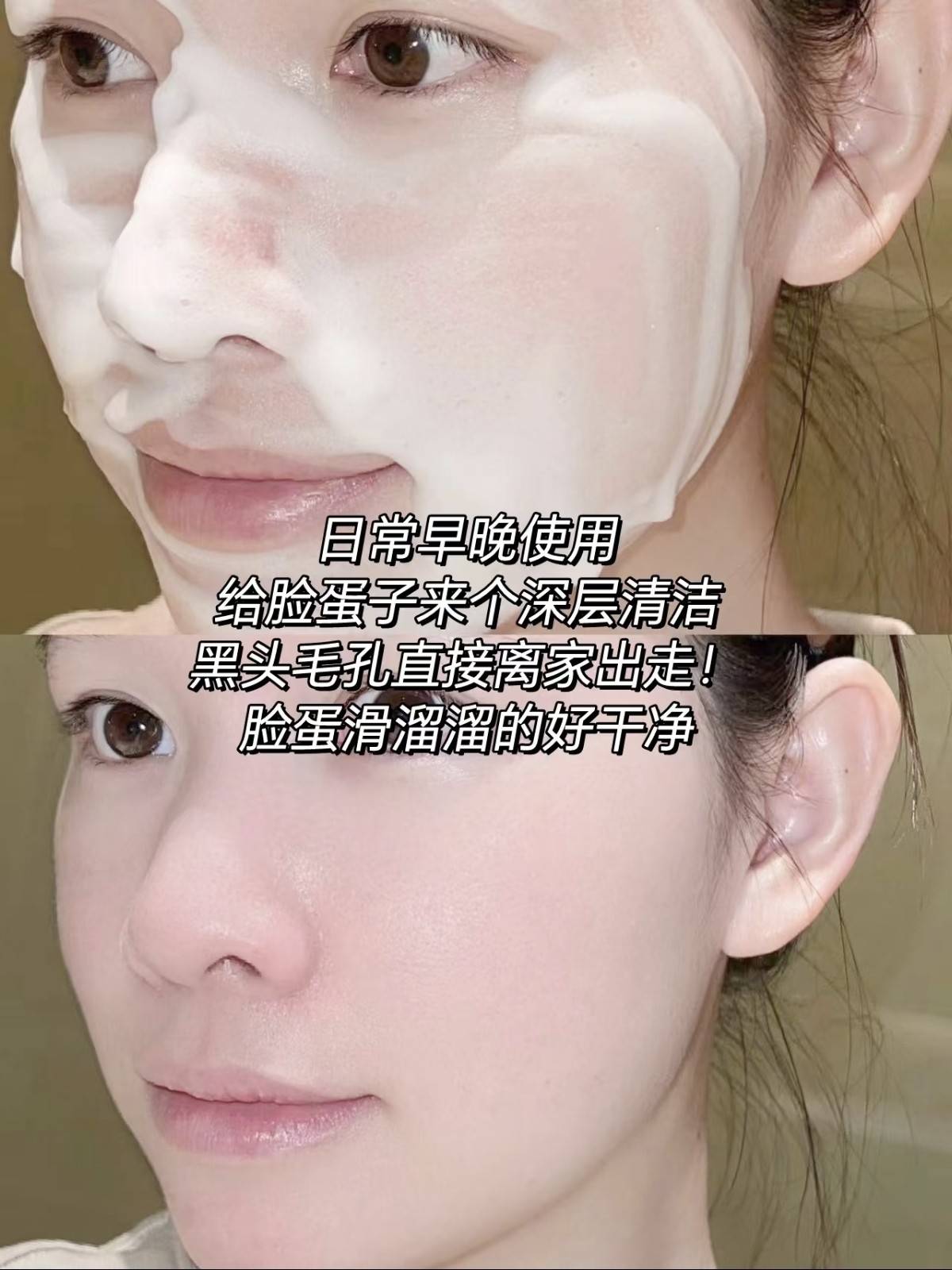 什么洗面奶祛痘?适合闭口痘痘的洗面奶品牌排行榜前十名推荐