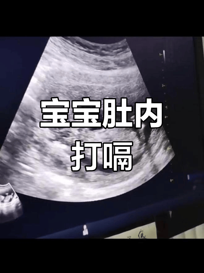 孕晚期胎动像心跳一样是怎么回事？可能是胎儿在打嗝