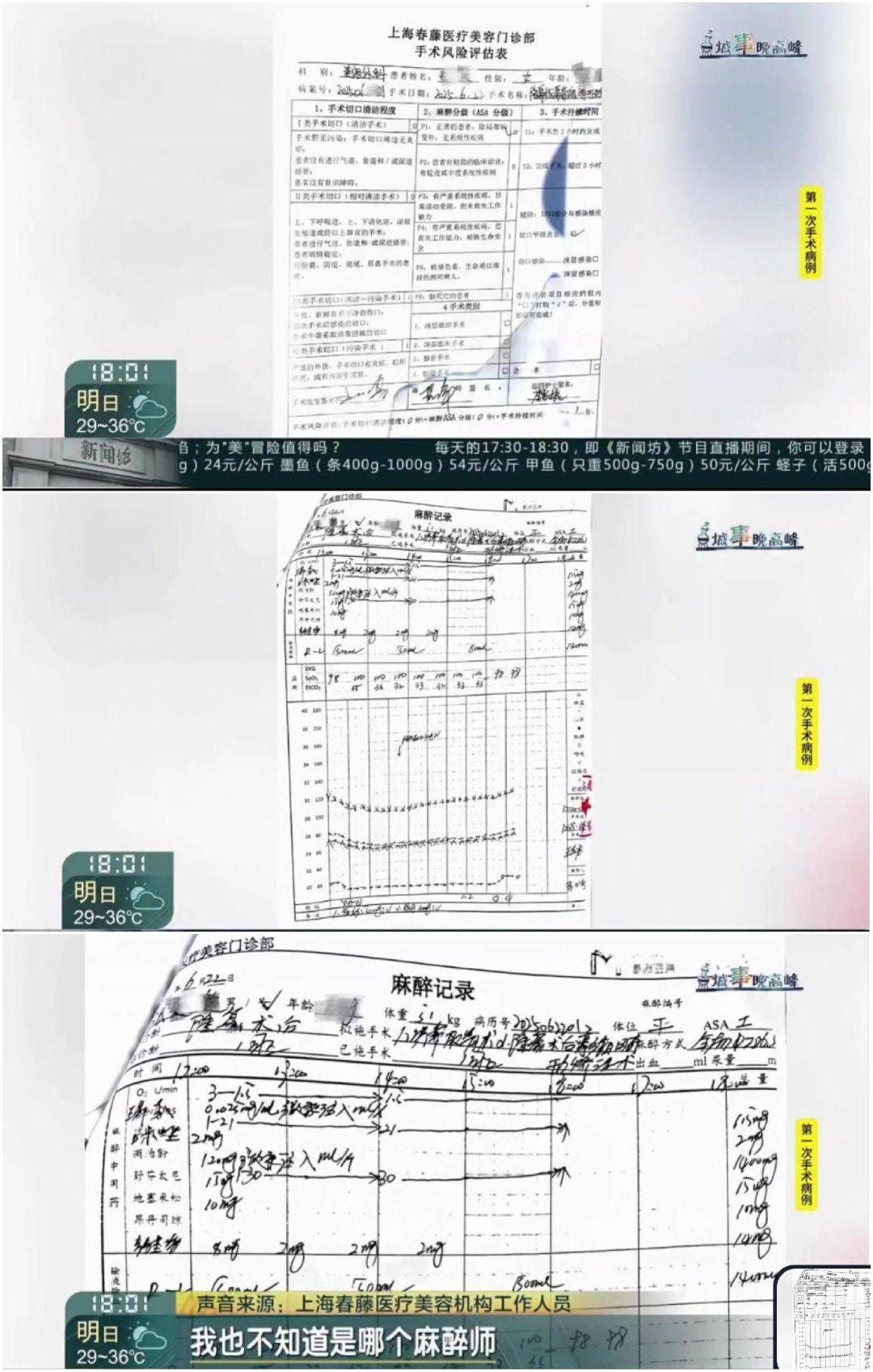 上海春藤医美被曝隆鼻手术失败:18天3次手术谁受得了?(图6)