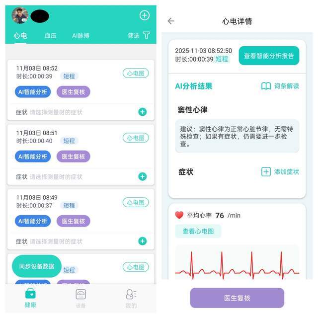 乐普心电血压计BP3体验：心血管健康管理“小卫士”。