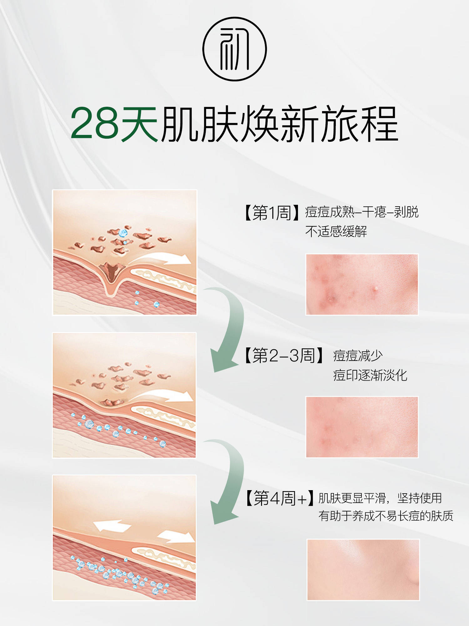 闭口对比