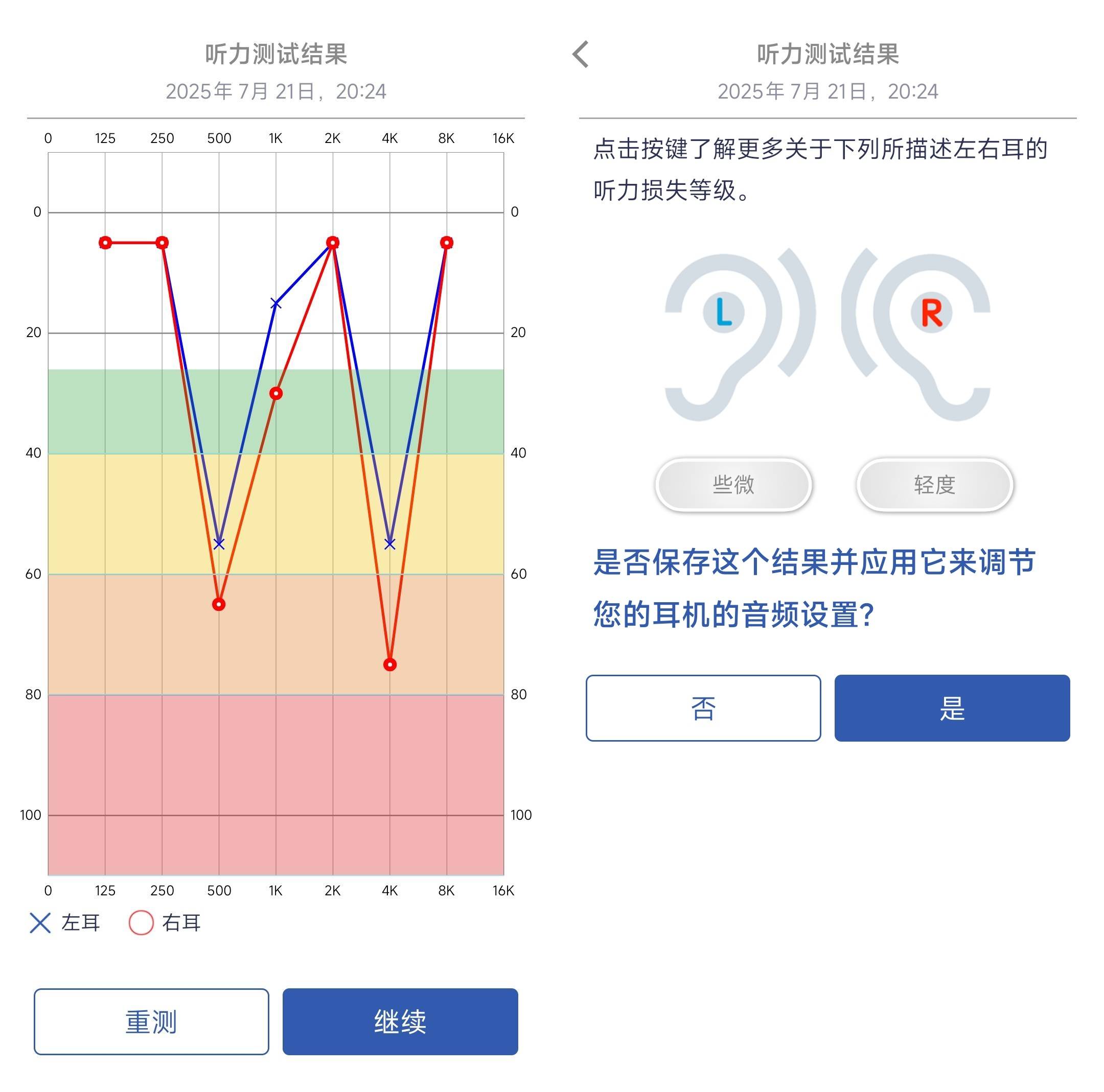 告别听觉迷雾，拨云见日暖阳来——町石tinx助听器