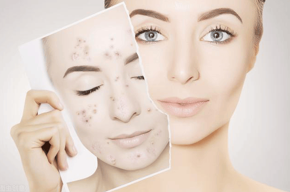 双十二除螨仪谁家好？这份除螨仪前十名排行榜别错过！放心买！