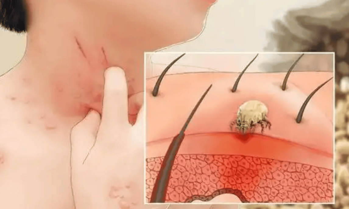 除螨仪啥牌子好用？一文带你了解除螨仪前十名排行榜！闭眼入