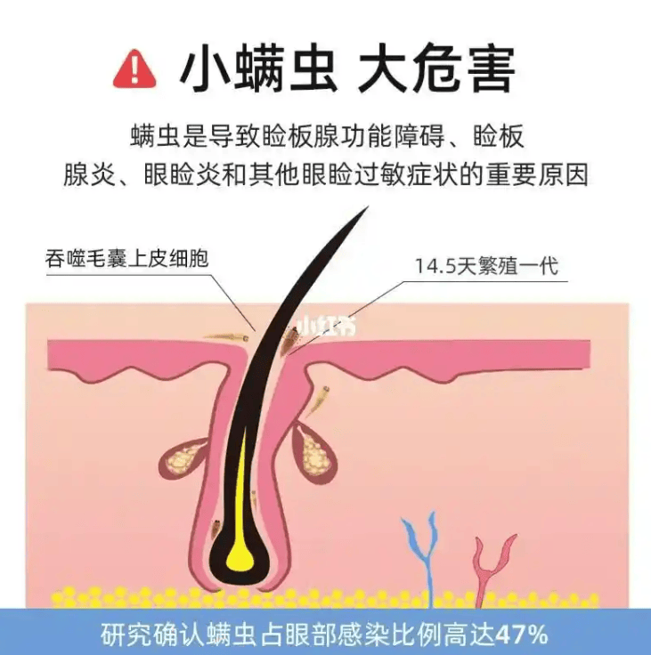 除螨仪有用吗？家用除螨仪有必要买吗？十大公认最好的除螨仪，小白精选款！