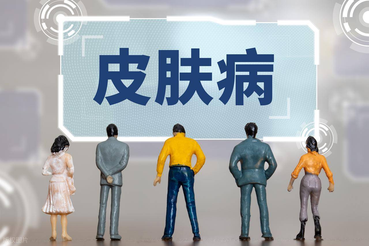 1828年传下的方子，专克牛皮癣？七代中医：病根在脾胃