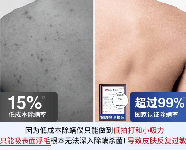 国产除螨仪哪个牌子好？除螨仪什么品牌好？好评如潮的除螨仪排行榜前十名，避坑指南收好！