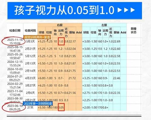 佛山爱尔眼科李亮亮博士个性化视觉训练,助4岁弱视宝宝视力从0.05逆袭至1.0(图2) 佛山爱尔眼科李亮亮博士个性化视觉训练,助4岁弱视宝宝视力从0.05逆袭至1.0(图2)