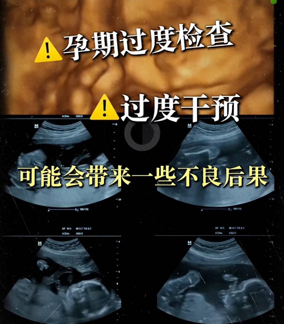孕期过期检查和干预,可能会带来一些不良后果