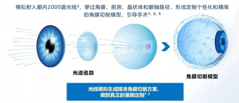 ​高考结束摘镜忙：贵港学子为圆军警梦 理性选择近视矫正方案(图1)