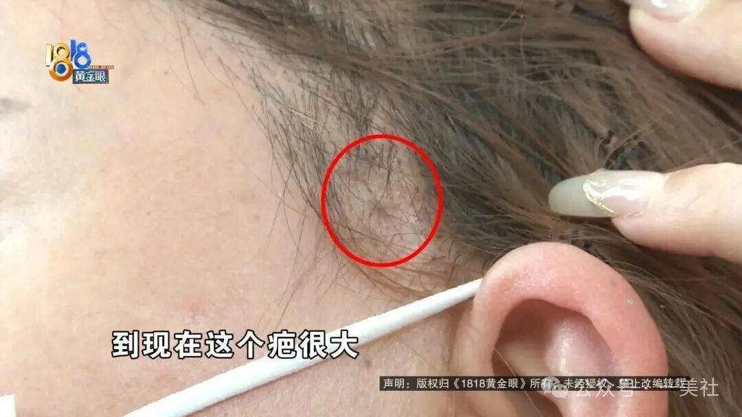 消费者的8万元医美恢复期还没到 宁波建国整形的危机倒先来了(图3) 文章配图-1