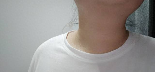 原创            医生呼吁：甲亢患者最好不要吃这3种食物，比高碘食物危害更大