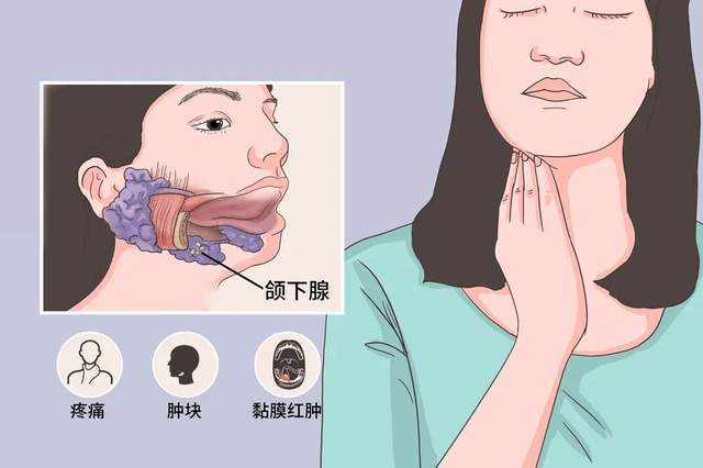 下颌缘模糊与颌下腺肥大有什么关系？魏广运科普面颈抗衰认知误区