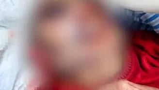 养老院安排智力障碍老人和89岁老人同住 发生互殴