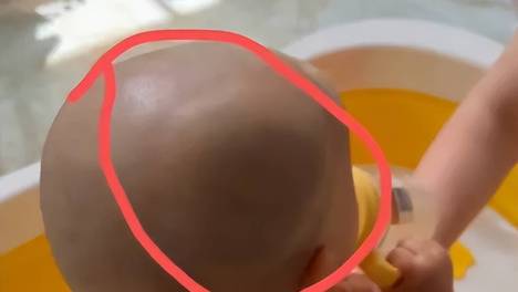 头骨骨折！孩子从餐椅摔下头磕瓷砖，奶奶瞒了3天
