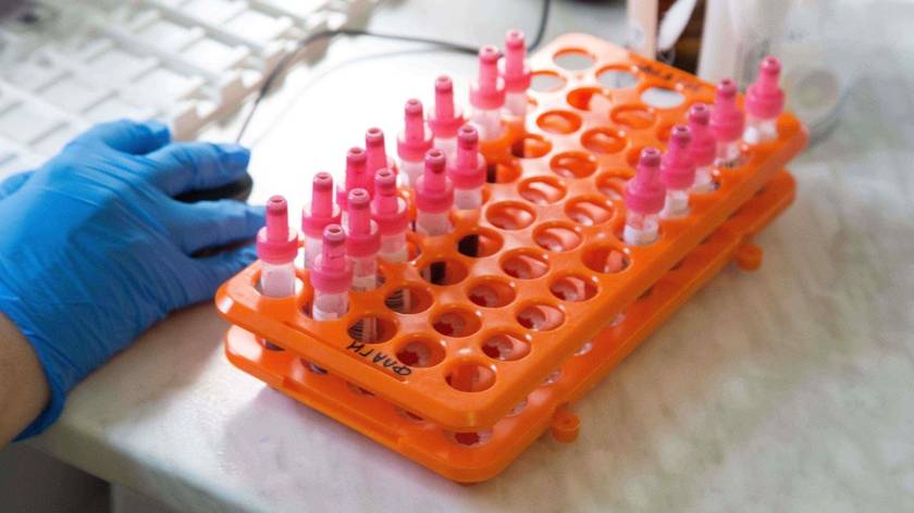 《柳叶刀》子刊发布最大规模HIV-1病毒地图，部分地区重组毒株占比攀升，会加剧耐药风险吗？