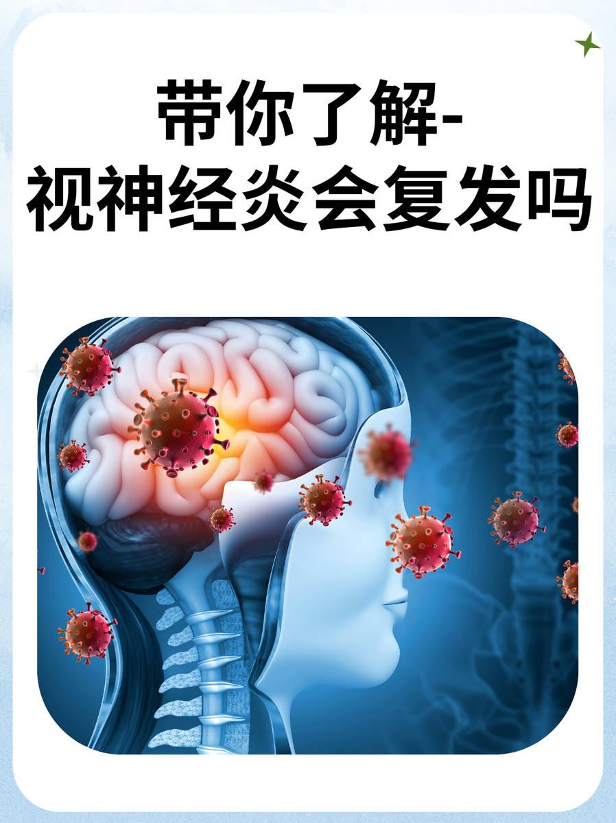 眼科医生徐永忠,带你了解-视神经炎会复发吗?