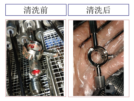 讓醫療手術更安全丨軟式管腔器械清洗機_技術_真空