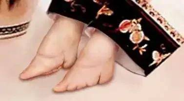 南方缠足简史①:把陋习当特权,清朝广州,潮州"扎脚"
