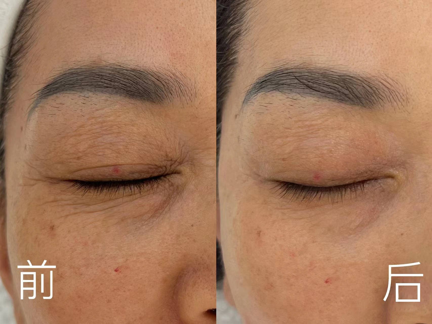 去皱紧致最厉害的眼霜,口碑最好眼霜第一名!