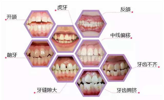 牙齿象限的划分图图片