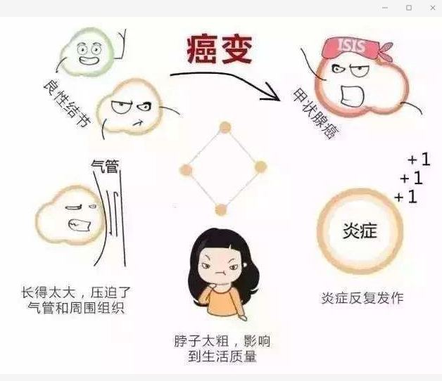 甲亢,甲减,桥本甲状腺炎,甲状腺结节多久查一次甲功,北京丰台广济医院