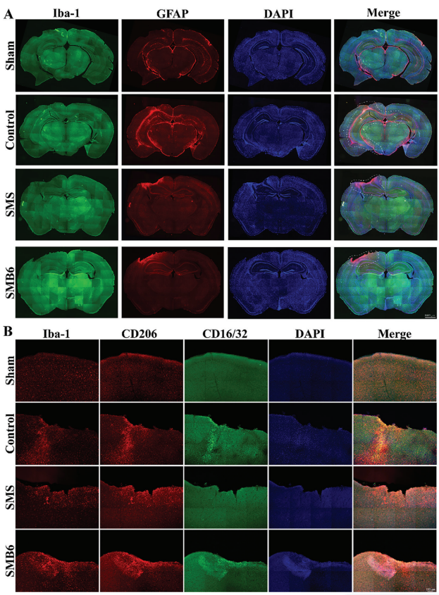 团队最新研究进展:一种新型3d打印双层颅骨脑补片促进