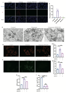 湘雅医院宋伟涛团队揭示p38 mapk抑制剂治疗青光眼的作用机制_死亡