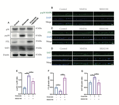 湘雅医院宋伟涛团队揭示p38 mapk抑制剂治疗青光眼的作用机制_死亡