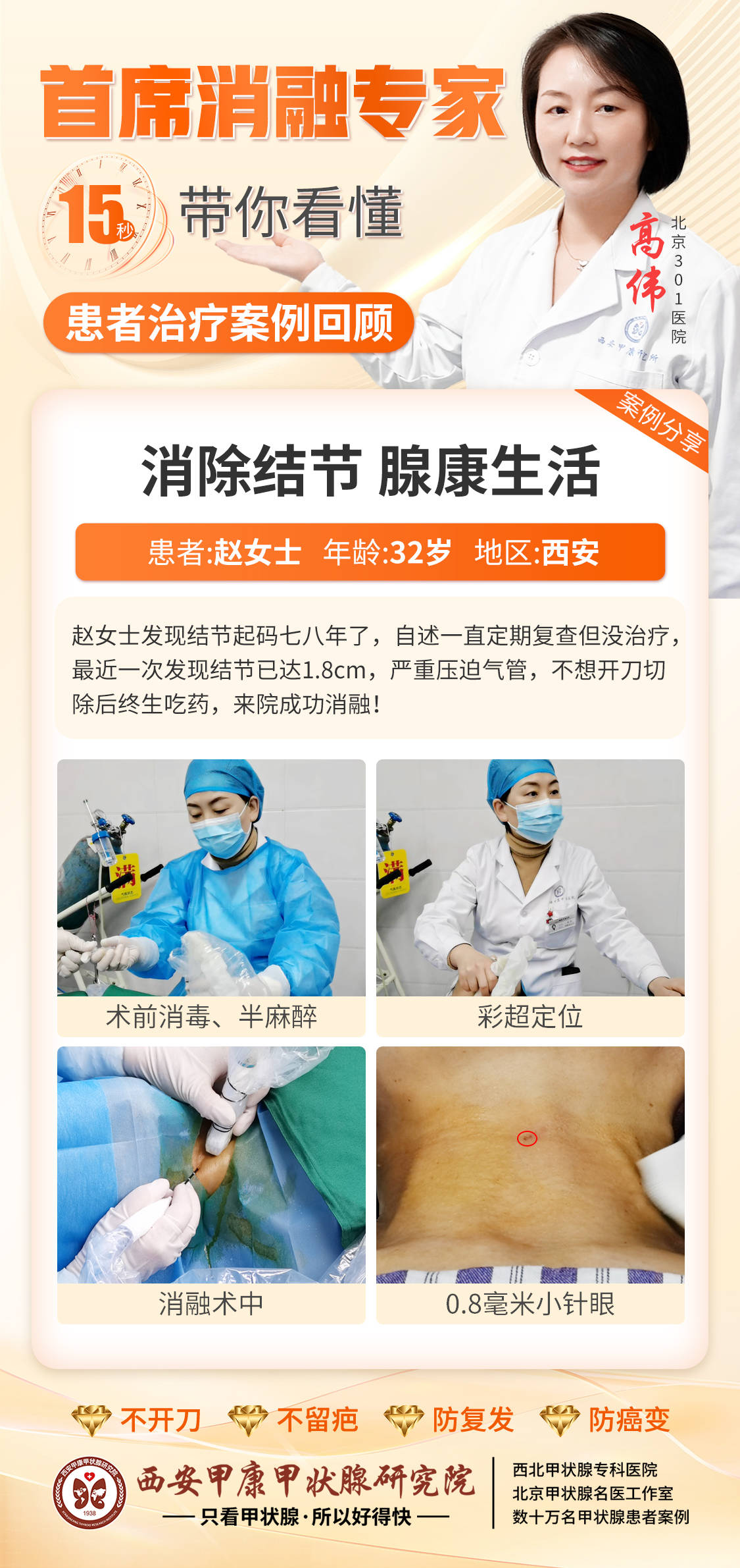 西安甲康医院高伟主任 今日开刀vs消融对比图-搜狐大视野-搜狐新闻