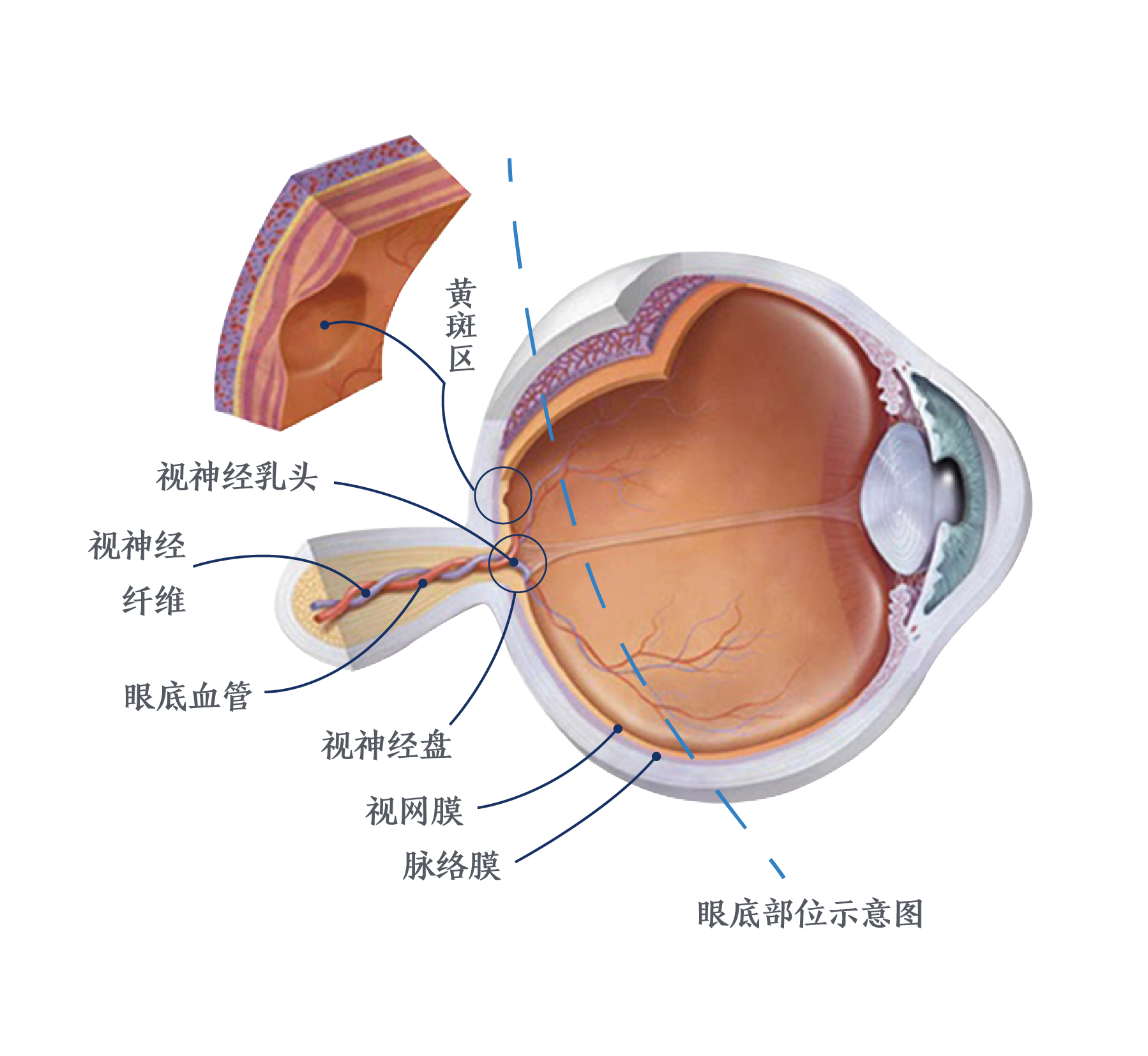 视网膜盲点图片
